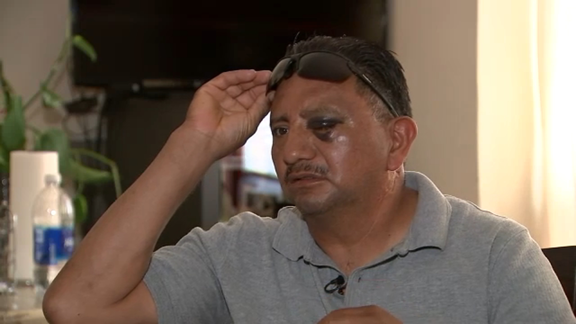 Long Beach ice cream vendor recovering after 4th of July assault leaves him unable to work