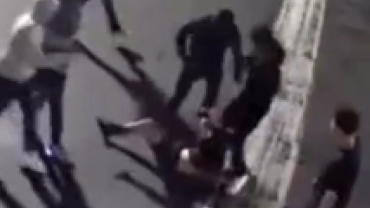 Man gets jumped over gold chain in Santa Ana